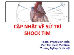 Cập nhật về sử trí shock tim - Phạm Minh Tuấn