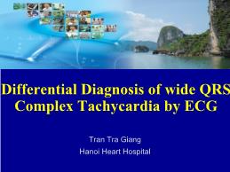 Differential diagnosis of wide QRS complex tachycardia by ECG