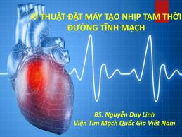 Kĩ thuật đặt máy tạo nhịp tạm thời đường tĩnh mạch - Nguyễn Duy Linh